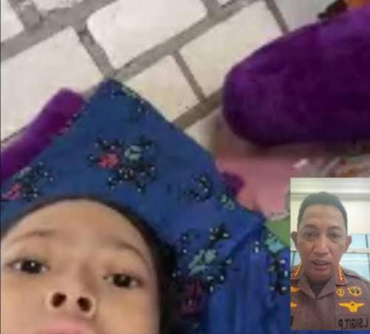 Respons Anak Penderita Tumor yang Minta Bantuannya di Instagram, Kapolri Kirim Tim Dokter dan Bawa ke RS