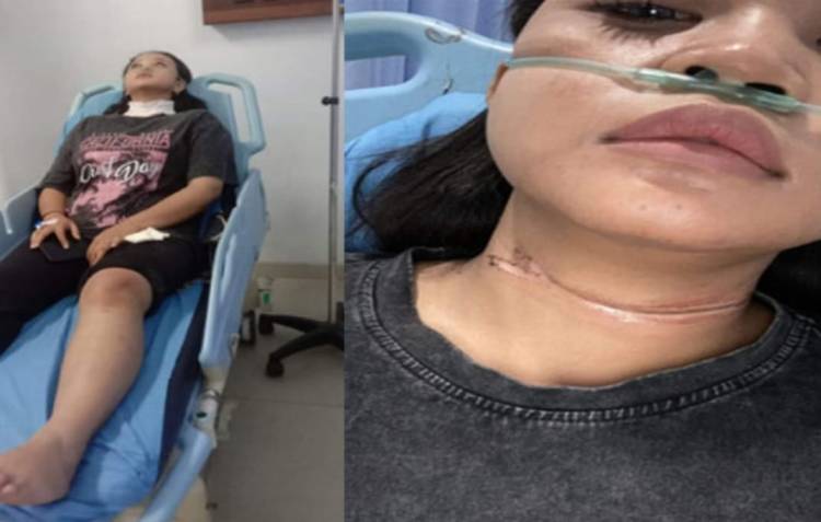 Kabel Menjuntai di Pekanbaru Kembali Makan Korban