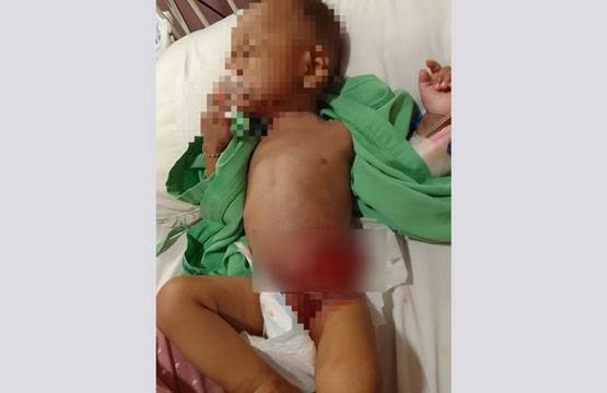 Paska Operasi Aidil di RS Keluarga Terhutang Rp.40 Juta, Butuh Uluran Tangan Dermawan