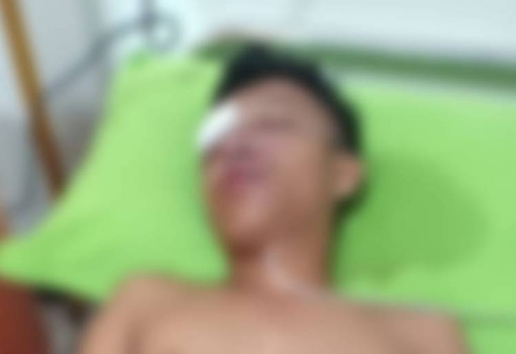 Keluarga Kecewa, Polres Kuansing Tak Tanggapi Serius Laporan Korban Pengeroyokan