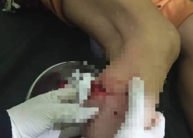 Tembilahan Mencekam, Teror Monyet Kian Meresahkan Warga, Belasan Korban Dilarikan ke Rumah Sakit