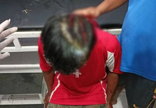 Luka 20 Jahitan, Kepala Pekerja Konsesi di Teluk Meranti Dicakar Harimau