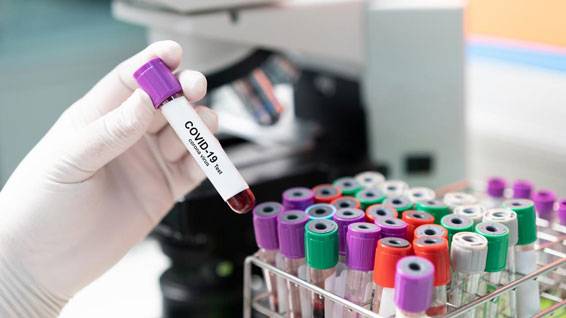 Selesai Isolasi, Siswa dan Guru Abdurrab Islamic School Dipulangkan