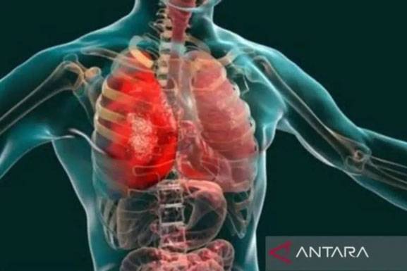 Masyarakat Diimbau Pakai Masker Cegah Pneumonia Misterius