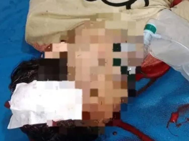 Pelajar di XIII Koto Kampar Tewas Terkena Tembakan Airgun