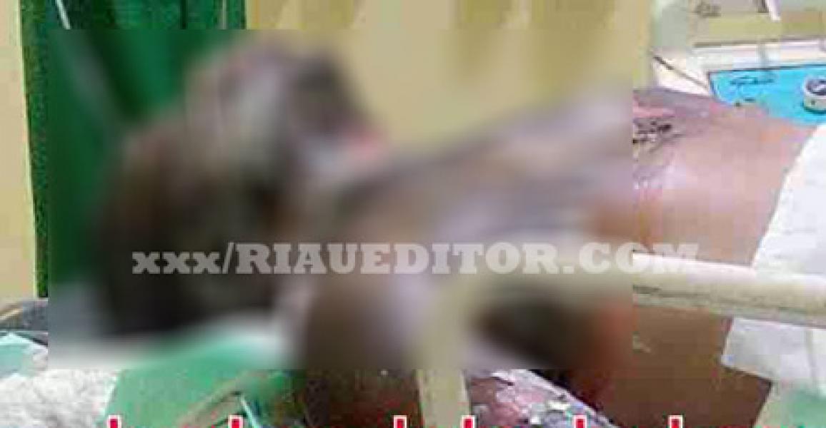 Akibat Kebakaran di Japura Satu Korban Mengalami Luka Bakar Serius