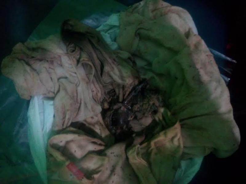 Warga Kecamatan Bunut Digegerkan Dengan Temuan Diduga Janin Manusia