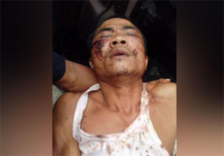 Kuasa Hukum Korban Pengeroyokan Minta Polisi Tangkap Pelaku