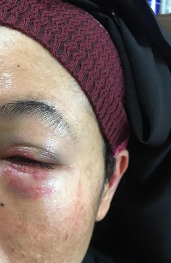 Colok Mata Istri Dengan Jari, Seorang Suami di Pekanbaru Ditangkap Polisi
