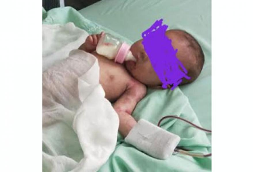 Meski Kondisinya Mulai Membaik, Balita Gizi Buruk dari Bunut Pelalawan Akhirnya Meninggal Dunia 