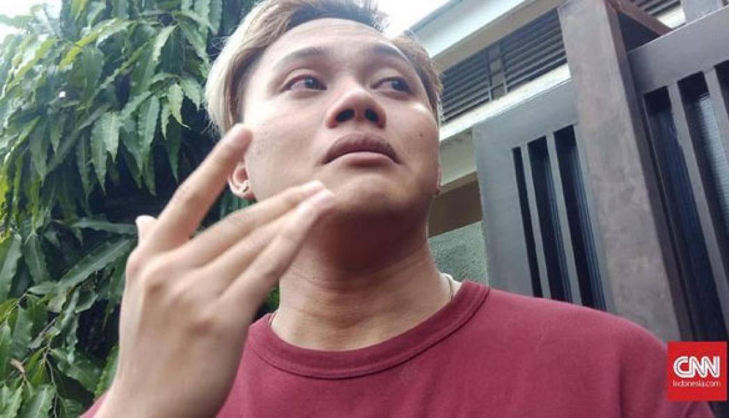 Putra Sule Lapor Polisi soal Kejanggalan Kematian Ibunya