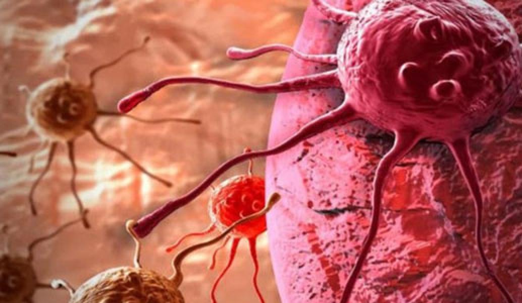 4 Makanan yang Meningkatkan Risiko Kanker