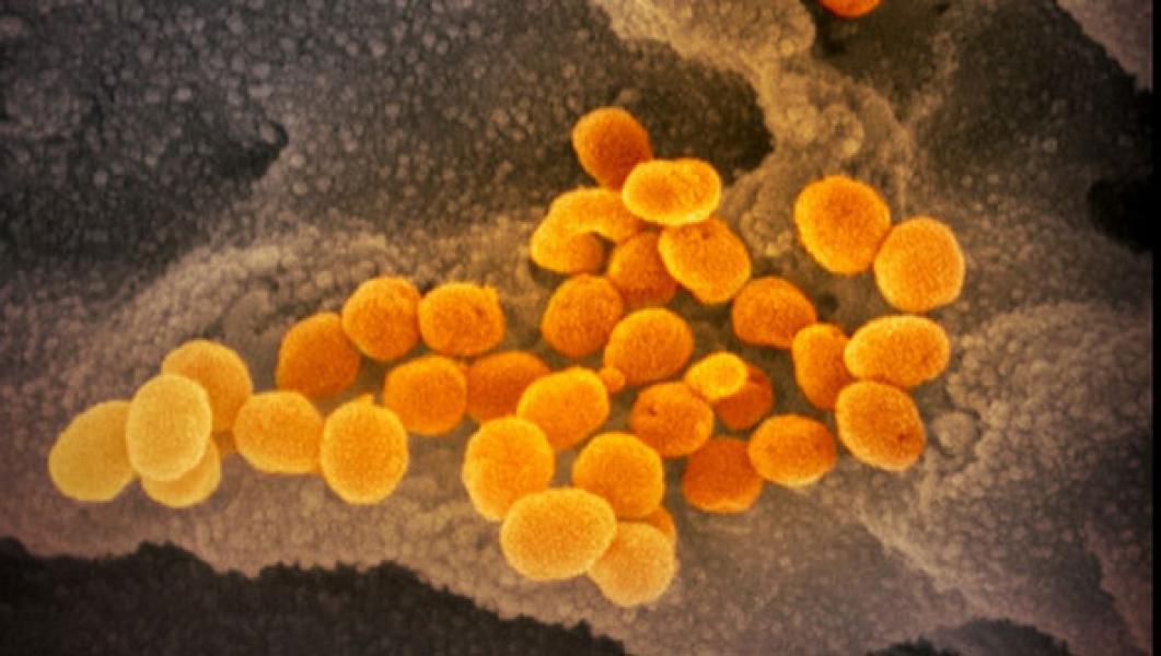 Virus Corona Makin Ganas di Korsel, 893 Orang Terinfeksi