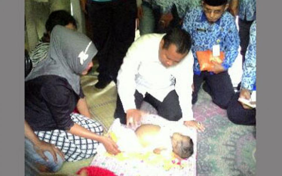 Bupati Irwan Upayakan Merujuk Bayi Suknia ke RSCM Jakarta