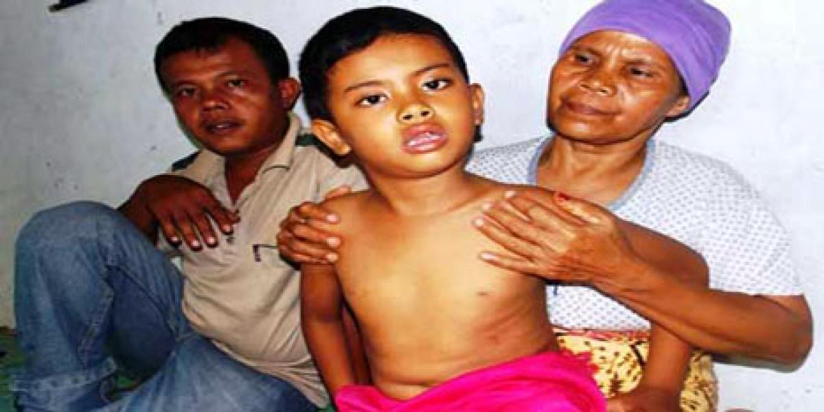Dikeroyok Teman Sekolah, Bocah SD di Rohul Mengalami Kelumpuhan