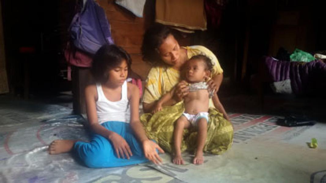 Jamkesda Tak Berlaku, Nurul Aisyah Balita Jantung Bocor Batal ke Jakarta