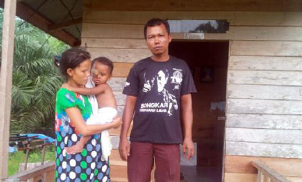 M Fathir Bocah Penderita Tumor Jinak Butuh Uluran Dermawan