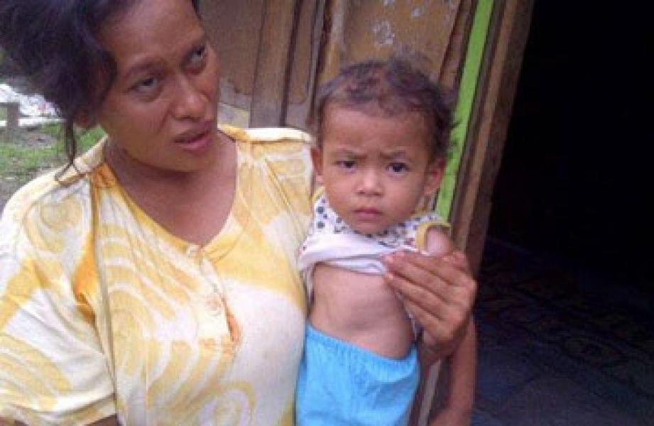 Nasib Nurul Aisyah Bocah Penderita Jantung Bocor Terkatung-katung, Diskes Pelalawan Angkat Tangan