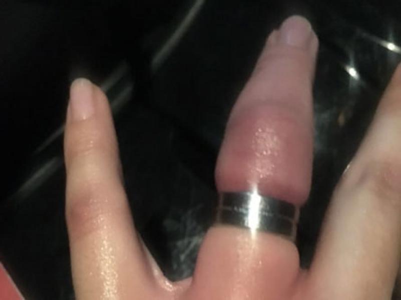 Geger Teror Cincin Melanda Perempuan di Bandung, Sudah Ada 6 Korban