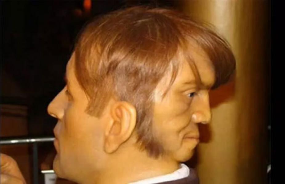 Punya Dua Wajah, Lelaki Ini Dijuluki Kembar Iblis