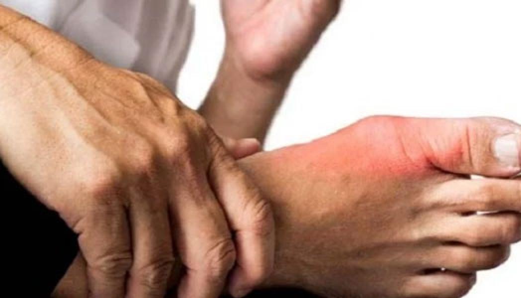 Dua Jenis Kacang yang Ampuh Turunkan Kolesterol dan Nyeri Asam Urat