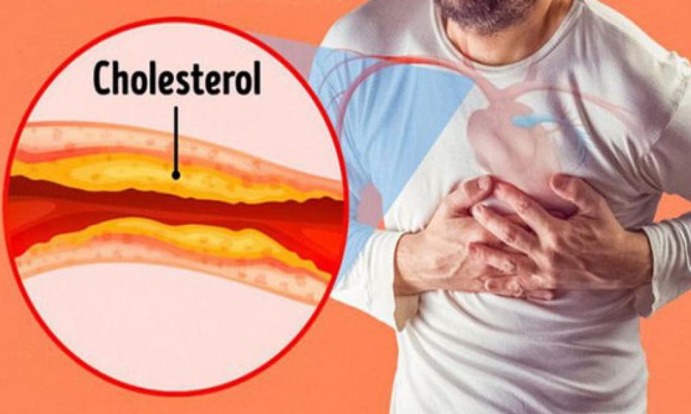 Kenali Gejala Arteriosklerosis yang Bisa Menyerang Anak Muda