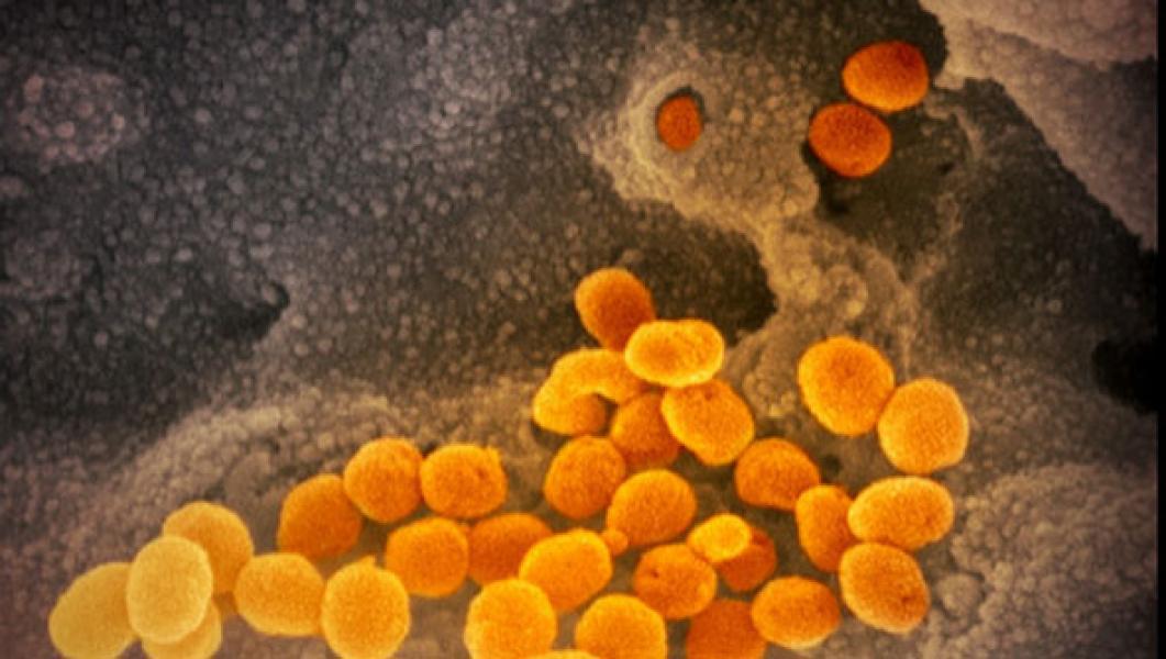 3 Obat Ini Berpotensi Manjur Lawan COVID-19