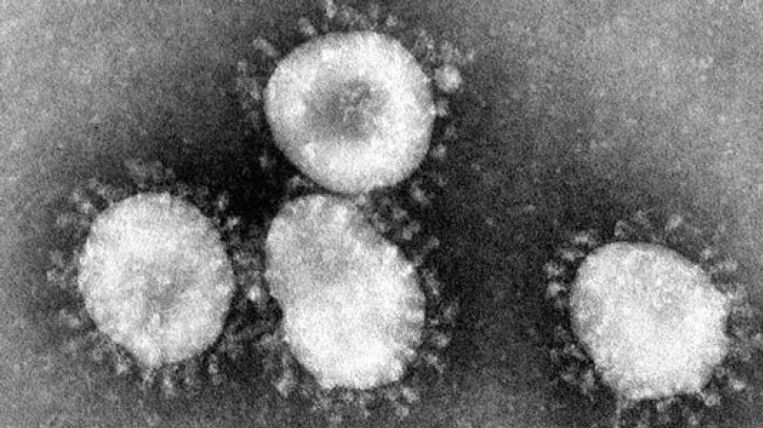 Ilmuwan: Virus Corona Bermutasi Jadi 2 Tipe