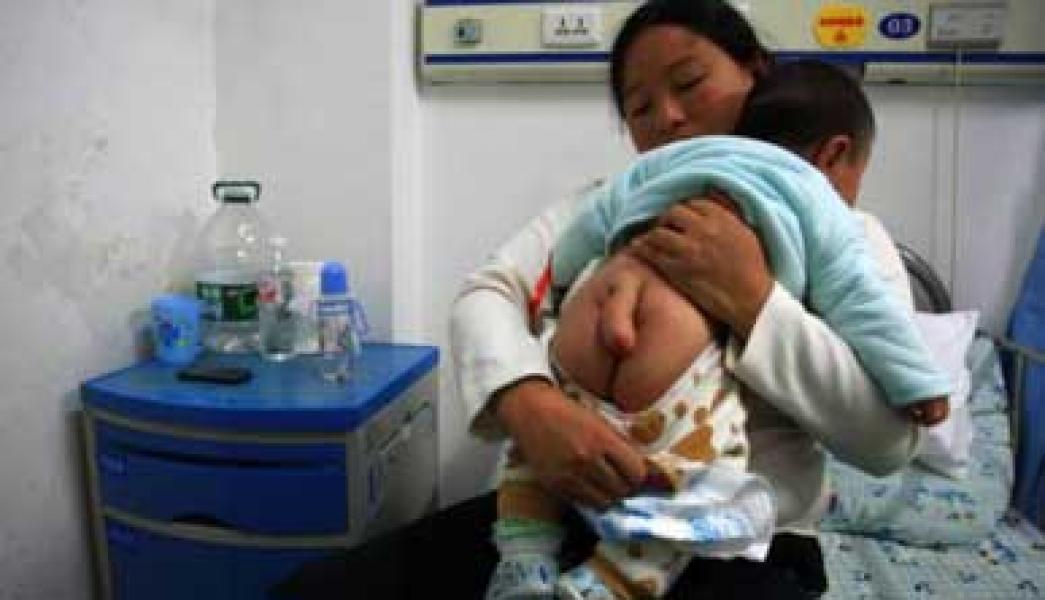 Bayi Asal China Memiliki Ekor Lima Inci