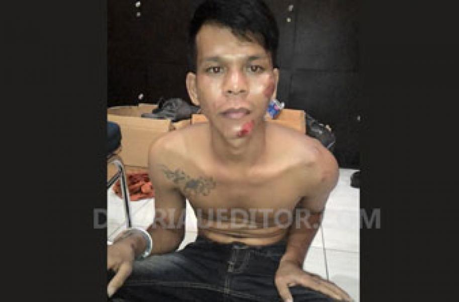 Begal Sial, Tiap Kali Menjambret Selalu Dihakimi Massa