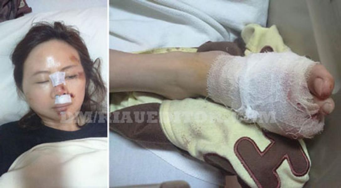 Tas Sandang Dibawa Kabur, IRT Korban Begal Kritis