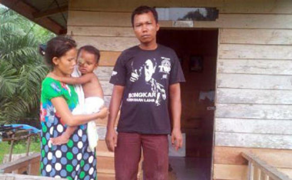 Hasil Test Pemeriksaan dan Tindakan Medis M Fathir Bocah Penderita Tumor Mata Diketahui 21 April Mendatang