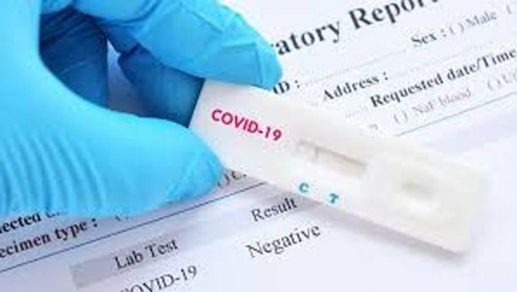 Hasil Rapid Test, 6.081 ODP di Riau Negatif