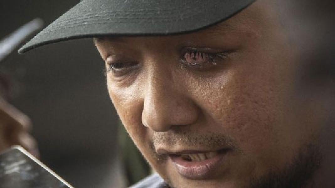 Novel Tersinggung Mata Kirinya Disebut Pakai Soft Lens