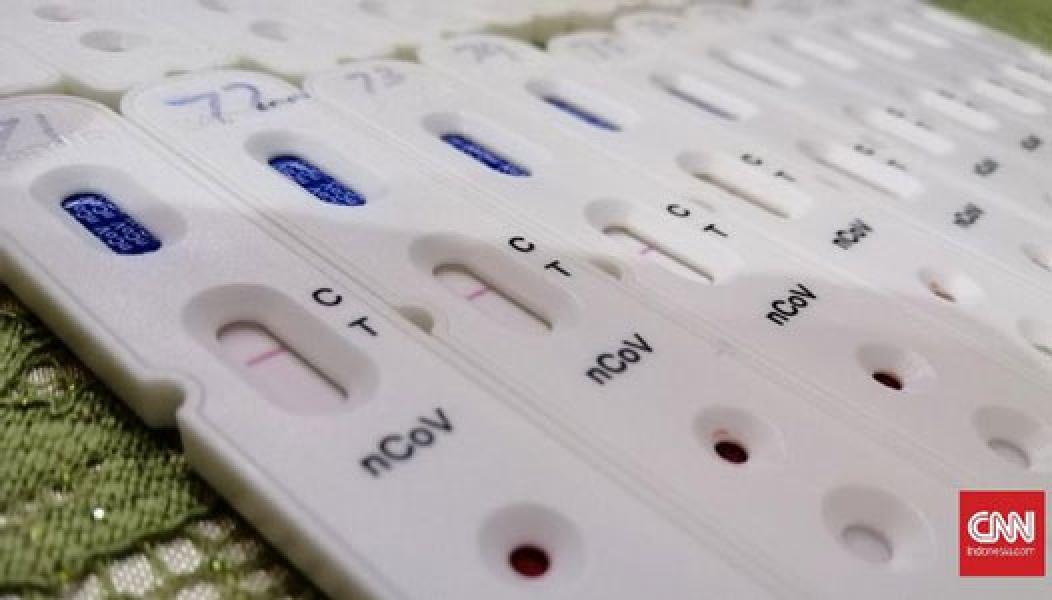 Produk Rapid Test Online Dihapus, Penjual Bisa Kena Sanksi