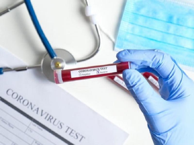 Tak Akurat, India Hentikan Penggunaan Alat Uji COVID-19 China
