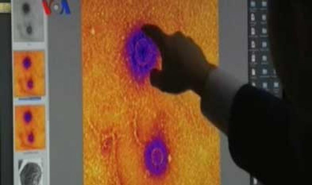 Dewan Minta Pemkab Siak Bentuk Tim Penanganaan Virus Mers