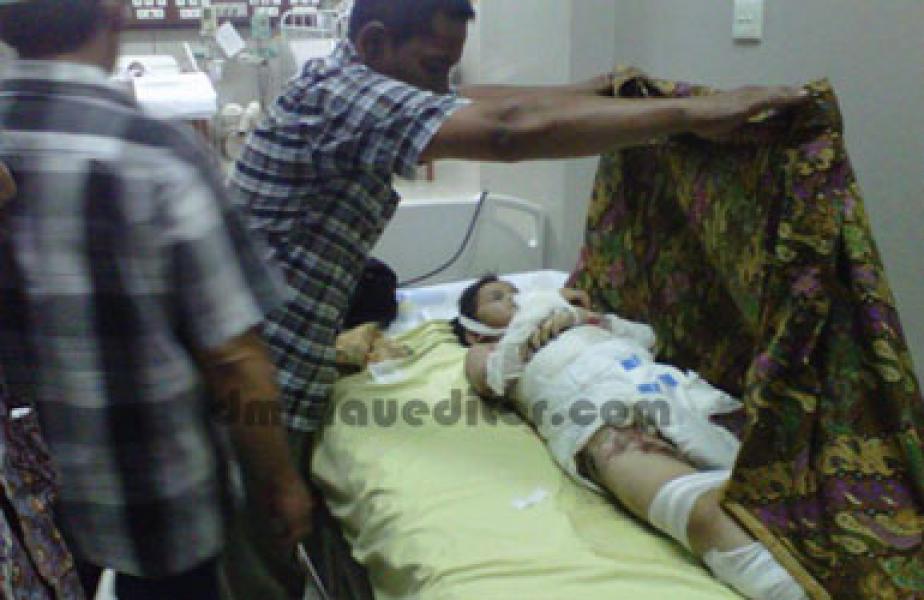 Disuruh Minum Spritus, Bocah SD Dibakar