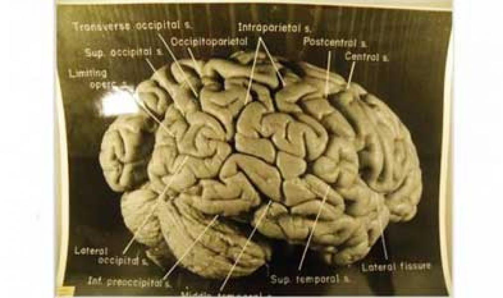 Studi: Tak Ada yang Spesial dari Otak Einstein