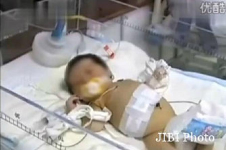 Bayi Berumur Delapan Hari Hamil