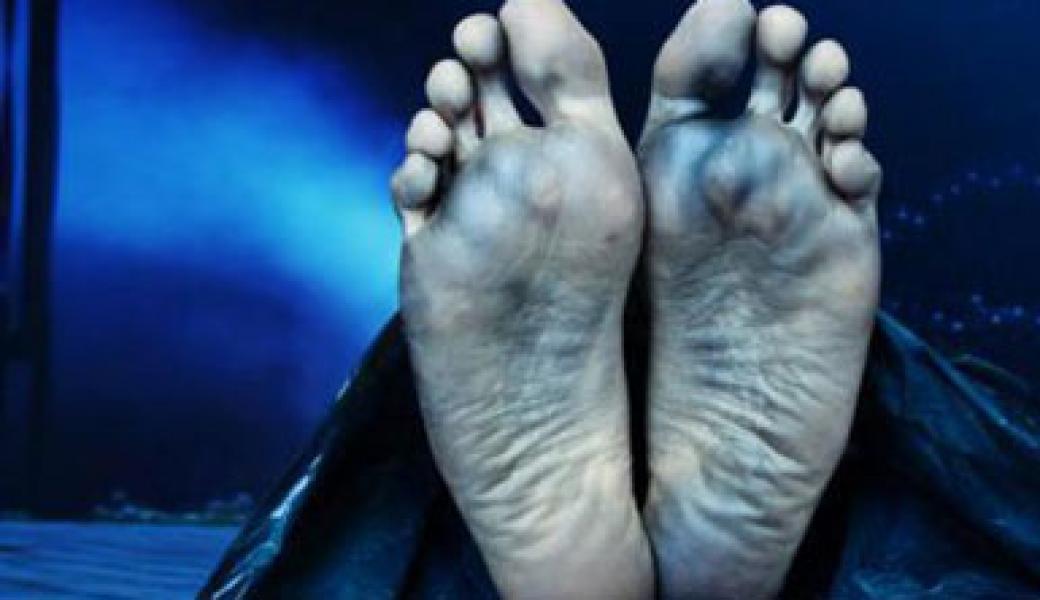 Pedagang Pasar Kaget Disambar Petir, 1 Tewas dan 2 Terbakar