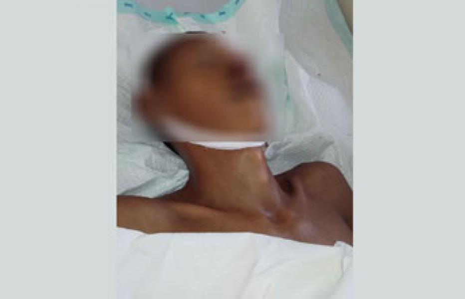 Mayat Mr X Akhirnya Dikebumikan Pihak RSUD Indrasari Rengat