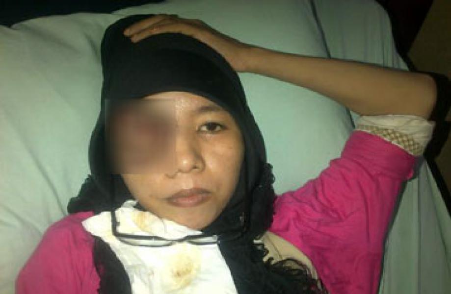 Satu Setengah Tahun Menderita Tumor Ganas, Rusiana Meninggal Dunia di RSUD dr Pratomo