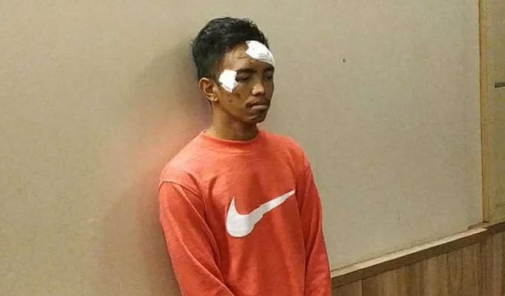 Pengakuan Pria yang Dianggap Bocah dan Dianiaya Aparat di Kampung Bali