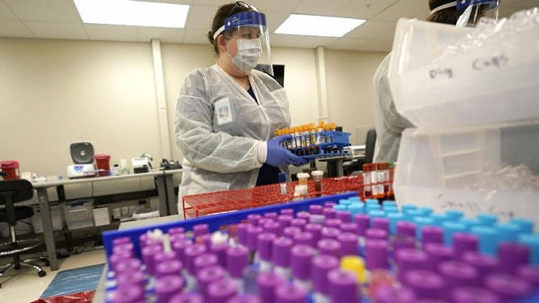 Belanda Temukan Antibodi yang Mampu Tangkal Virus Corona!