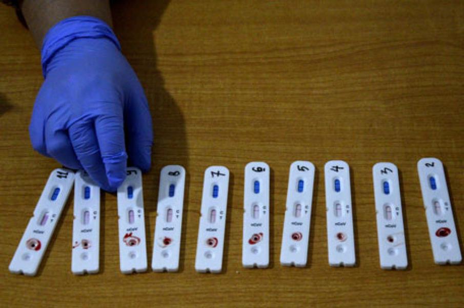 Hasil Rapid Tes Massal, 10 Warga Tenayan Raya Didapati Reaktif Covid-19