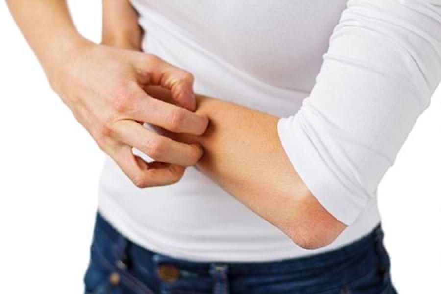 Ketahui Obat Gatal-Gatal Seluruh Badan di Sini