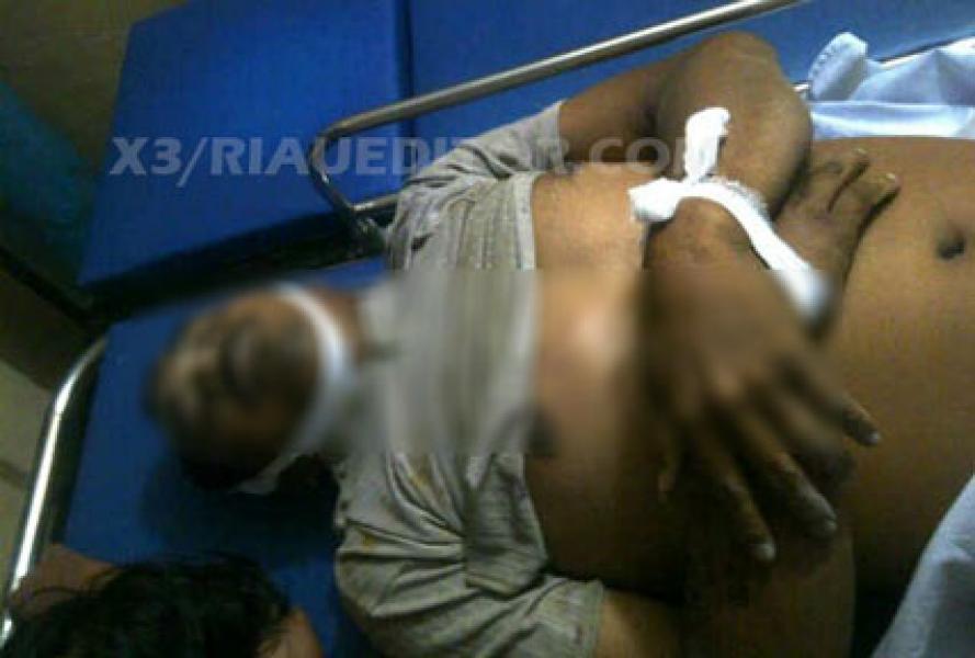 Jatuh Dari Loading Ramp, Karyawan PKS PT WSN Kuansing Tewas