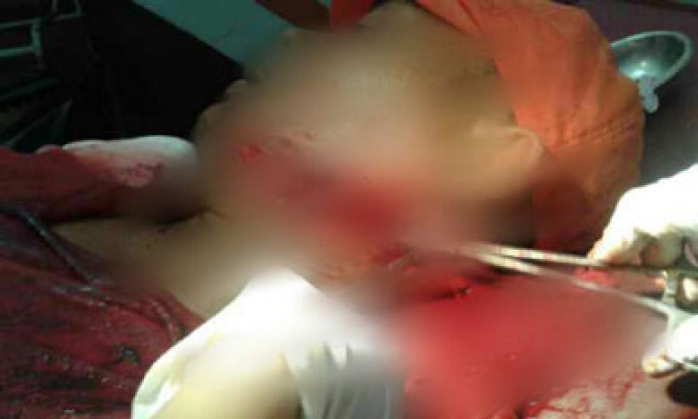 Mandor Kebun PT Palma I Dibacok Adik Karyawannya