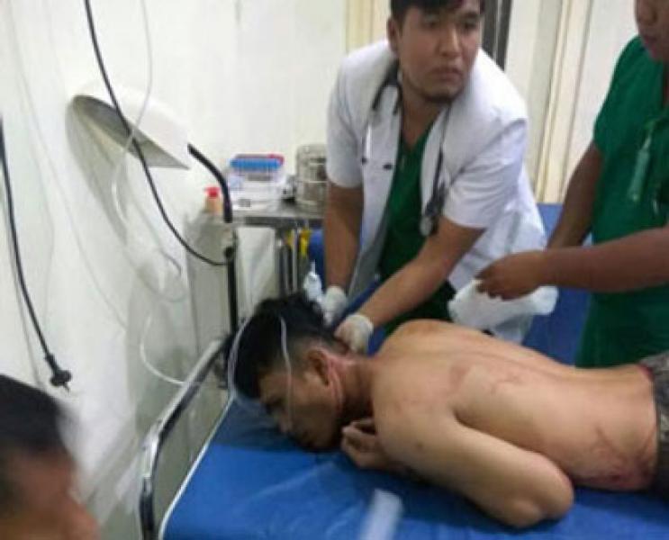 Tak Rela Pacar Dicemooh, Pemuda Tembilahan Jadi Korban Pengeroyokan